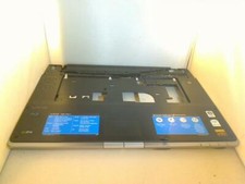 Gehäuse berschale handauflage gebraucht kaufen  Hofheim