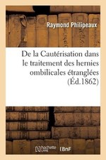 de la Cautrisation Dans Le Traitement Des Hernies Ombilicales trangles por Raymon comprar usado  Enviando para Brazil
