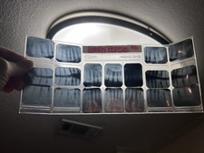 Dental ray full for sale  Baton Rouge