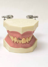 Zahnmodell natural dental gebraucht kaufen  Morsbach