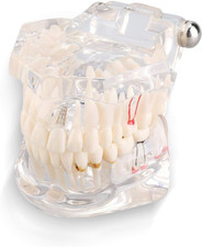 Modello impianti dentali usato  Roma