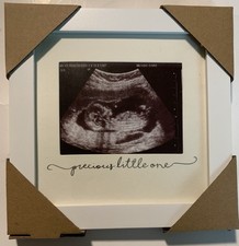 Solo baby sonogram for sale  Ozark