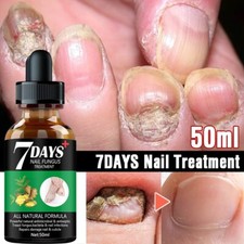 Tratamiento de hongos en las uñas 7DAYS suero cuidado eliminación de manos y pies segunda mano  Embacar hacia Mexico
