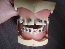 Dental zahnarzt zahntechnik gebraucht kaufen  Mammelzen