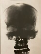 Cranio radiografia anni usato  Roma