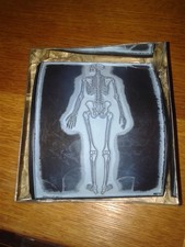 skelett medizin gebraucht kaufen  Krayenberggemeinde