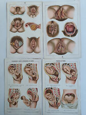 Lot planches médicales d'occasion  Scey-sur-Saône-et-Saint-Albin