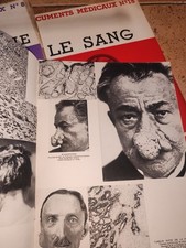 Lot revues médicales d'occasion  Le Mans