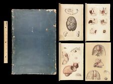 Usado, 1829 Anatomy & Pathology ATLAS 86 Color Illustrated Disease Cruveilhier Medicine comprar usado  Enviando para Brazil