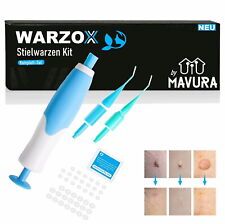 WARZOX Skin Tag Remover Kit Stielwarzen Set Fibrom Kosmetik Entferner 54tlg comprar usado  Enviando para Brazil