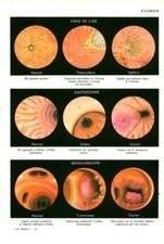 Cabinet curiosité anatomie d'occasion  France