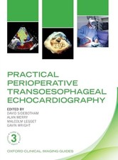Practical perioperative transo usato  Spedire a Italy