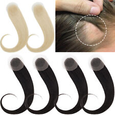 Thin skin hairline for sale  Hebron