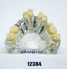 Camlog demomodell schaumodell gebraucht kaufen  Ratekau