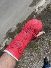 Gipsarm safs weissgips gebraucht kaufen  Bochum