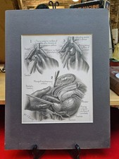 Historical prostate medical for sale  Philadelphia