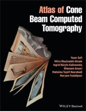 Atlas cone beam for sale  Jessup