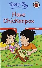 Topsy tim chickenpox for sale  UK