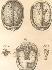 Anatomy human brain for sale  BRIGHTON