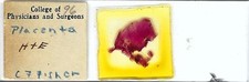 human placenta for sale human placenta for sale Los Angeles