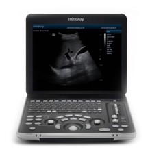 4d ultrasound machine for sale 4d ultrasound machine for sale Atlanta