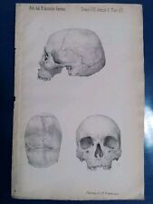 1881 litografia teschio usato  Roma