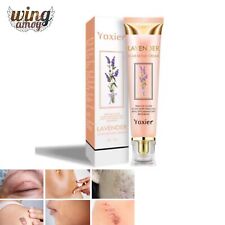 Usado, Creme reparador de cicatrizes de lavanda YOXIER creme antiestrias creme para remoção de cicatrizes comprar usado  Enviando para Brazil