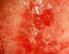 Tugtupite berryllite type for sale  Shipping to United Kingdom