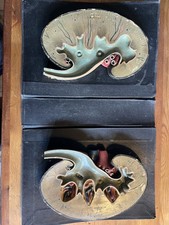 Anatomical model kidney for sale  SEVENOAKS