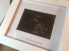 Iheipye baby sonogram for sale  Gainesville