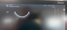 Ic5 endocavity tvs for sale  NOTTINGHAM
