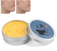 Norse organics acne for sale  Sartell
