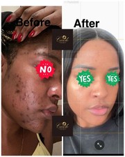 Extra whitening face for sale Extra whitening face for sale  SUTTON