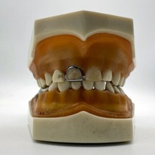 Vintage columbia dentoform for sale  Ardmore