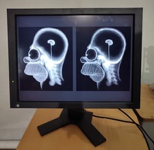 Eizo RadiForce GS310 medical LCD monitor RTG screen Befundungsmonitor Röntgen na sprzedaż  PL
