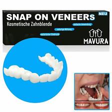 Snap veneers kosmetische gebraucht kaufen  Deutschland