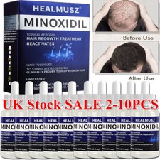 Minoxidil extra strength for sale  DERBY