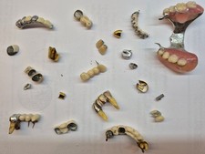 sucata dental 80 gramas comprar usado sucata dental 80 gramas comprar usado  Enviando para Brazil