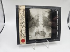 Old xray slabs d'occasion  Expédié en Belgium