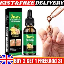 Ginger nail treatment for sale  STOKE-ON-TRENT