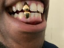 gold teeth for sale gold teeth for sale LONDON