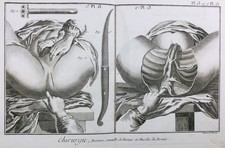 Gynécologue 1779 chirurgie d'occasion  Tuchan