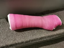 Gipsarm sac links gebraucht kaufen  Willstätt
