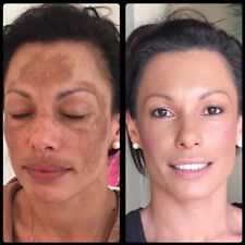 Mederma advanced gel d'occasion  Expédié en France