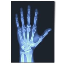 Human hand ray for sale  SELBY