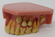 Modelo antigo de estudo de dentes UNITEK dental Typodont desenvolvimento pediátrico idade 9-12 comprar usado  Enviando para Brazil