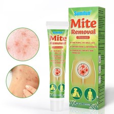 Mite and lice d'occasion  Expédié en Belgium