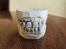 Vintage plaster dental for sale  Flagstaff