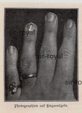 Bild fingernagel fingernagelbi gebraucht kaufen  Deutschland