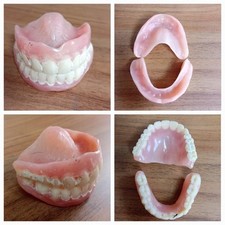 Vintage dentures upper for sale  PETERBOROUGH